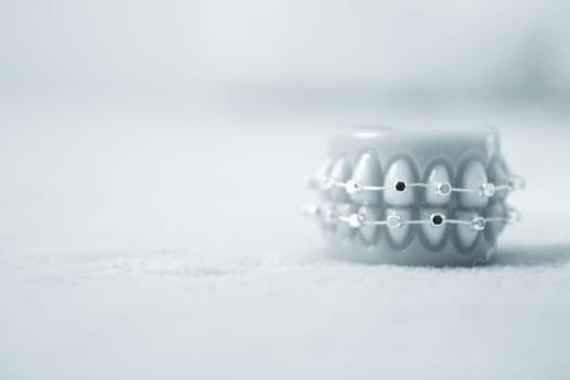 Metal orthodontic denture base. No people