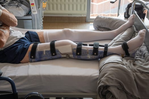 a man with a broken leg in an orthese in bed in a clinic after an accident, High quality photo
