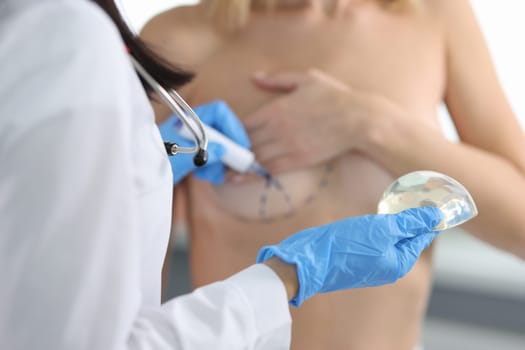 Doctor draws marks on female breast cosmetic surgery operation. Silicone implant and breast lift concept