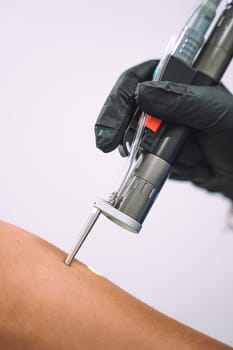 Close up shot of gloved hand with the laser hair removal machine's handpiece along woman hand. Alexandrite laser techhnology removing hair. Beauty procedureBeauty technology concept