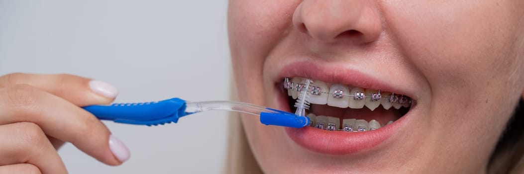 Caucasian woman cleaning her teeth with braces using a brush. Widescreen