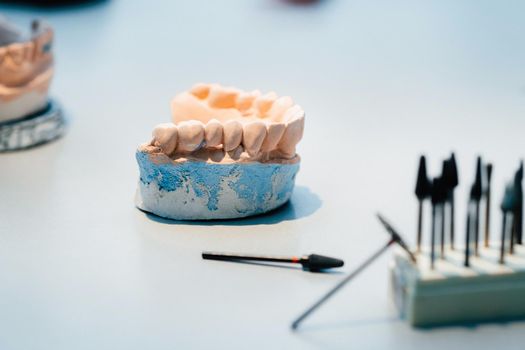 Model of teeth made of plaster of the jaw for dental technicians.