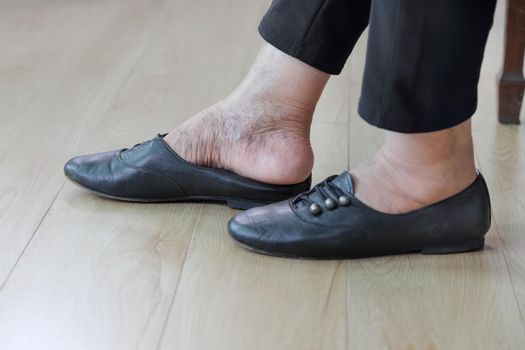 Elderly woman putting on shoes.