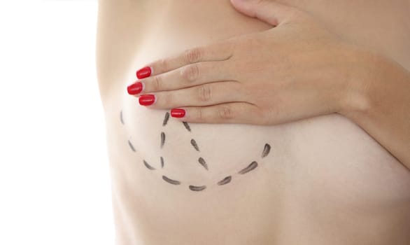 Correction lift breast augmentation and plastic surgery. Preparation for mammoplasty concept