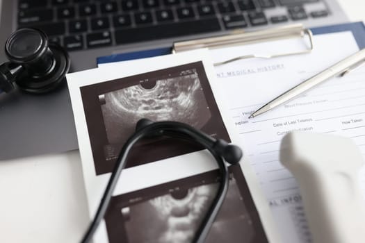 Modern ultrasound device with sensor and ultrasound of uterus. Medical chart stethoscope and ultrasound probe on table