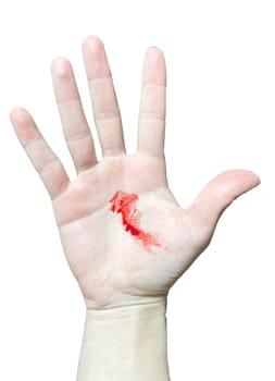 A bloody hand on a white background. Bloodstains on the palm of a real bloody hand.