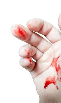 A bloody hand on a white background. Bloodstains on the palm of a real bloody hand.