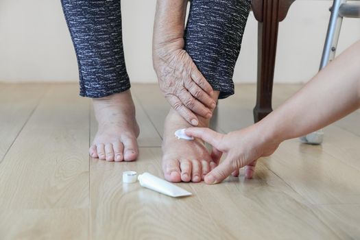 Elderly woman putting cream on swollen feet