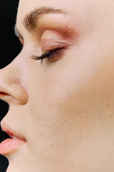 close macrophotography of a woman's face with problematic skin, on the topic of care. Vertical photo without retouching. High quality photo