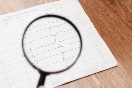 Cardiorgram line and magnifier lens close up with blurred background