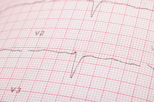 Cardiogram lines on pink paper close up, macro photo