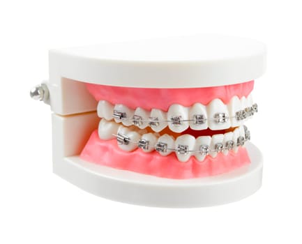 Teeth model with metal wire dental braces or dental instruments isolated on white background, Save clipping path.