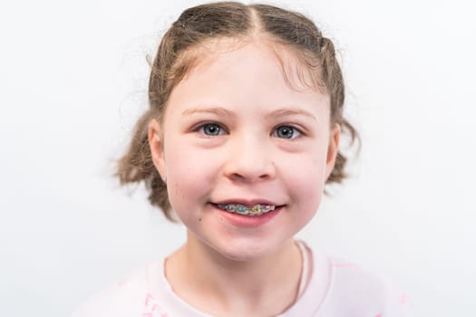 Little girl with rainbow braces smiling at the camera.