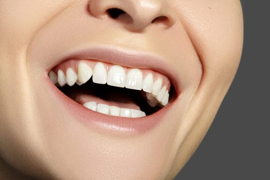 Cropped half face portrait of woman. Closeup Dental Beauty. Beautiful Macro with perfect White Teeth. Whitening Tooth and Wellness Treatment