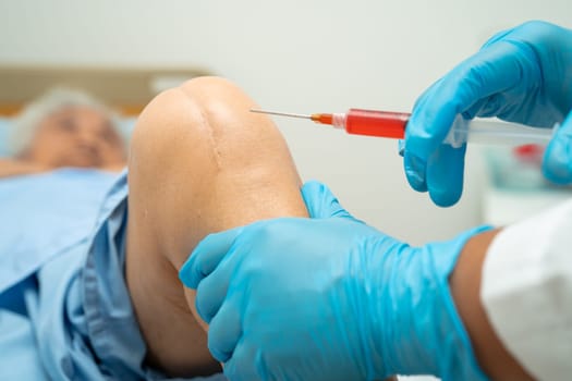 Asian doctor inject Hyaluronic acid platelet rich plasma into the knee of senior woman to walk without pain.