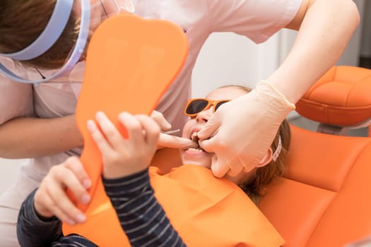 Dental plate. Expansion of the jaw in a child. teenage girl holding an orthodontic plate in her hands
