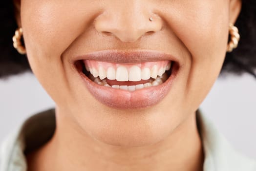 Smile, dental teeth and face of black woman in studio isolated on a white background. Tooth care, cosmetics and happiness of female model or person with lip makeup, gums and oral health for wellness.