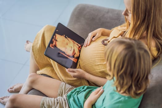 Mom and her son looking on ultrasound image of his unborn baby brother on mothers tablet. Concept of healthcare and family happiness expecting baby.