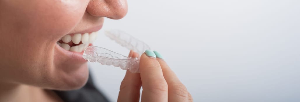 Close-up of a woman putting on transparent plastic retainers. The girl uses a device to straighten her teeth. Widescreen.