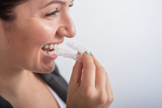 Close-up of a woman putting on transparent plastic retainers. The girl uses a device to straighten her teeth.