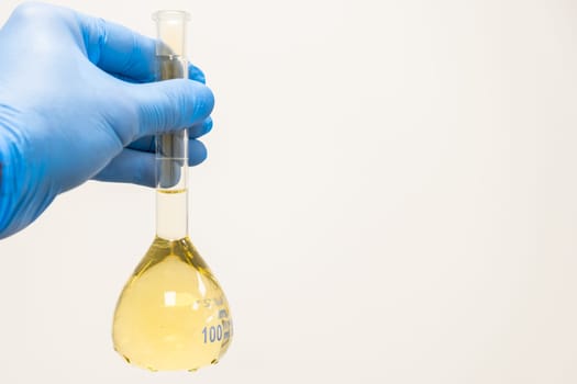 Scientist in blue rubber holding a yellow solution in the flask on the white background with copy space. Urea analysis. Clinical, toxicological and forensic analysis.