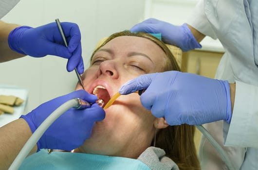 The dentist treats the teeth of the patient in the clinic. Close-up of the face, gloved hands, tools for dental treatment.