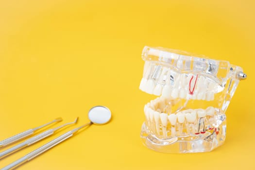 Teeth model and instrument dental on yellow background.