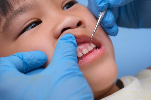 Close-up in the oral cavity of a healthy child with beautiful white teeth. Young girl opens her mouth to reveal healthy teeth, hard and soft palate. Dental and oral health check