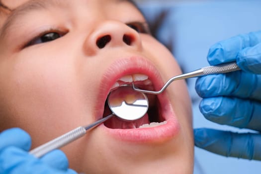 Close-up in the oral cavity of a healthy child with beautiful white teeth. Young girl opens her mouth to reveal healthy teeth, hard and soft palate. Dental and oral health check