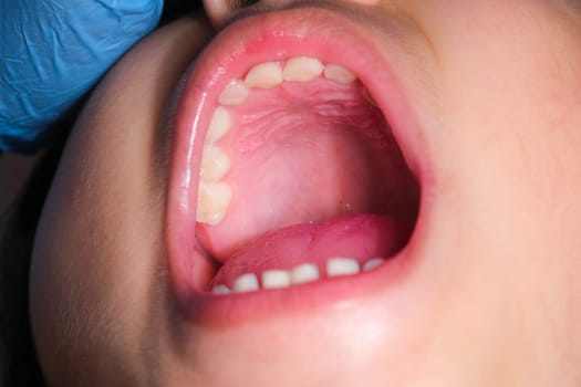 Close-up of the hard palate in the mouth of a healthy child with beautiful rows of baby teeth.