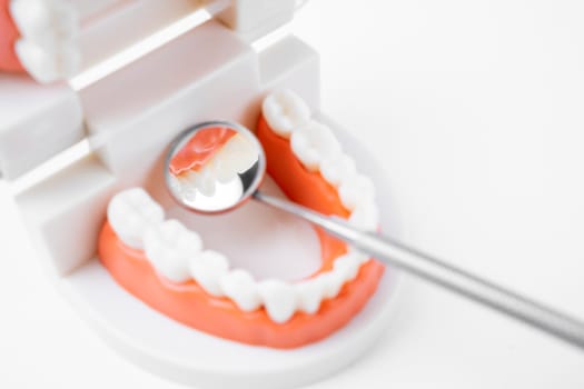 Teeth model with dental mirror on white background