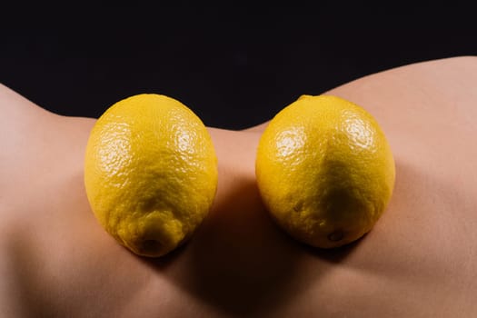 Young woman with cellulite problem and lemon on a dark background, closeup