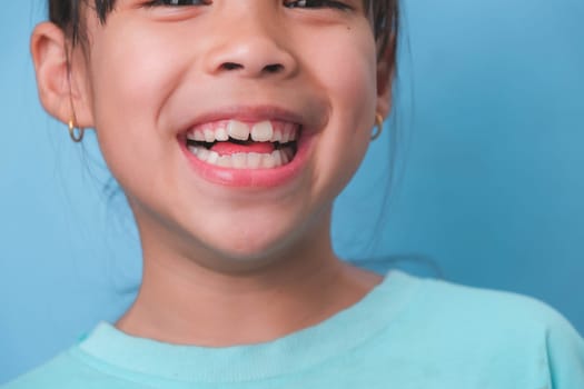 Close-up of smiling young girl revealing her beautiful white teeth on a blue background. Concept of good health in childhood.