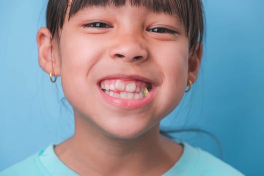 Smiling cute little girl eating sweet gelatin with sugar added isolated on blue background. Children eat sugary sweets, causing loss teeth or tooth decay and unhealthy oral care.