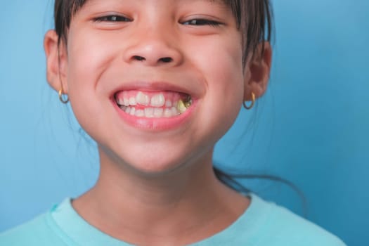 Smiling cute little girl eating sweet gelatin with sugar added isolated on blue background. Children eat sugary sweets, causing loss teeth or tooth decay and unhealthy oral care.