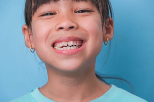 Close-up of smiling young girl revealing her beautiful white teeth on a blue background. Concept of good health in childhood.