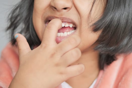 detail shot of child with teeth missing.