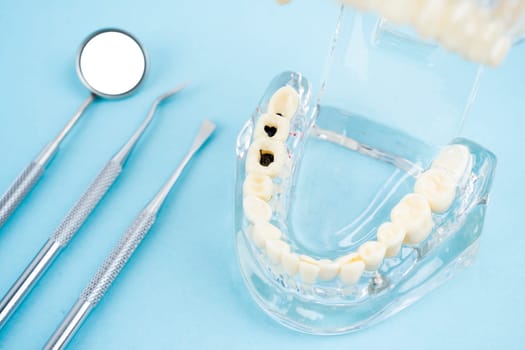 Healthy and decayed teeth model and mouth mirror, Dental concepts.