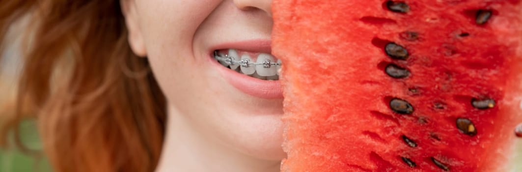 Beautiful red-haired woman smiling with braces on her teeth covers half of her face with a slice of watermelon outdoors in summer.