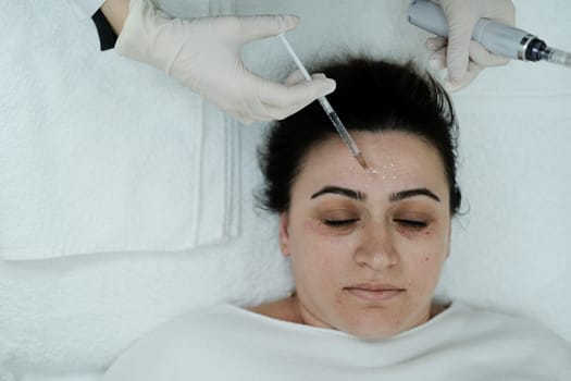 Cosmetologist applying mesotherapy serum. Preparing skin for microneedling procedure. Caucasian.