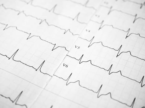 Medical and healthcare concept. Close up of an electrocardiogram in paper form. ECG or EKG record paper. The heartbeat is shown on the graph. Minimalism style template for medical blog. Soft focus