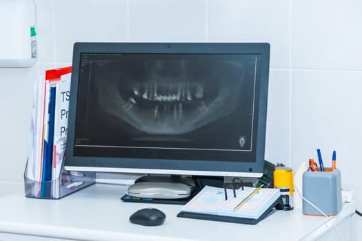 Medical equipment for the dentists. mouth x-ray on computer