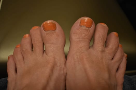 Female Feet, Toes with Peeling Orange Nail Polish. High quality photo