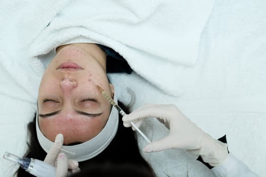 Cosmetologist applying mesotherapy serum. Preparing skin for microneedling procedure. Caucasian.