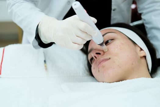 Closeup view of woman having microneedling procedure applied on her face. Microneedling. Dermapen. Esthetician. Health and beauty.