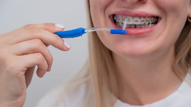 Caucasian woman cleaning her teeth with braces using a brush. Cropped portrait