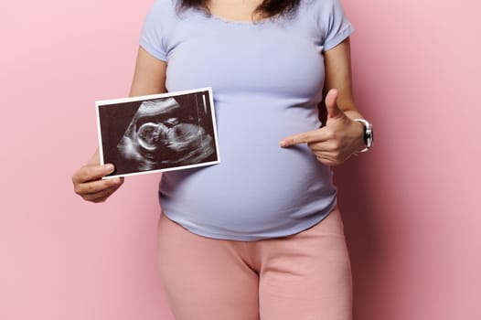 Midsection of a pregnant woman pointing at her belly, showing her newborn baby sonography, ultrasound scanner image, over isolated pink background. Pregnancy. Maternity. Expecting baby Lifestyles
