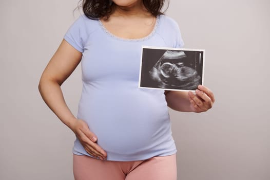 Cropped view pregnant woman gently caressing her belly, showing at camera the ultrasound scan with her newborn baby, isolated on white background. Pregnancy diagnostics. Healthcare Gynecology Medicine