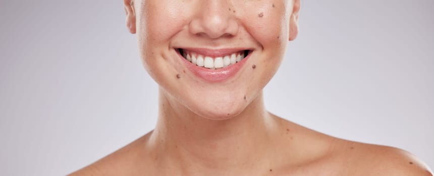 Face smile, dental and teeth of woman in studio isolated on a gray background. Skincare makeup, cosmetics and lips, mouth and oral hygiene of happy female model with veneers, invisalign and wellness