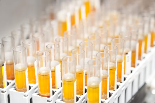 research in the laboratory, test tubes. Analyzes